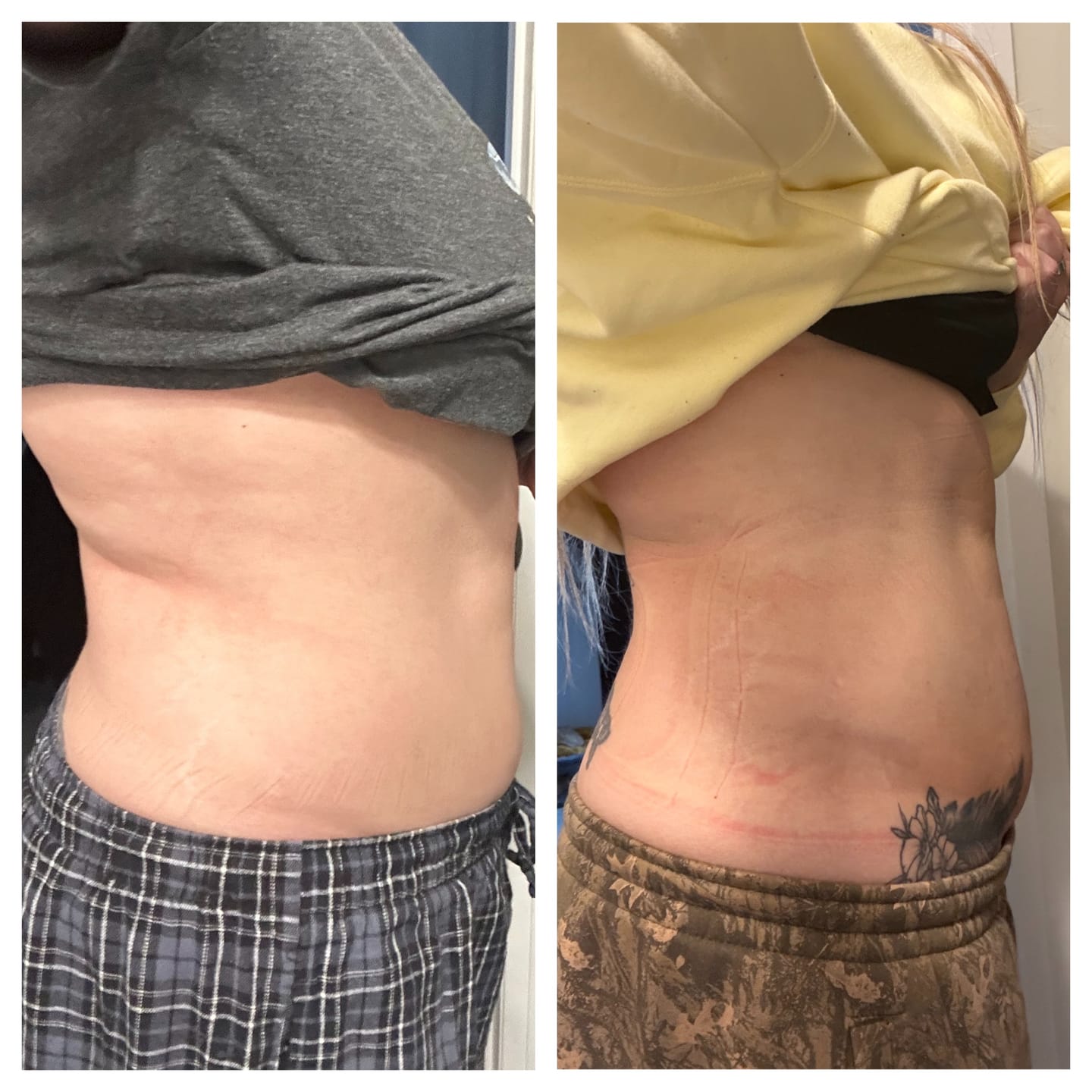 HealWrap®