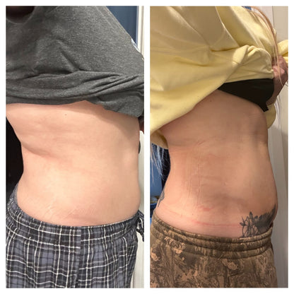 HealWrap®